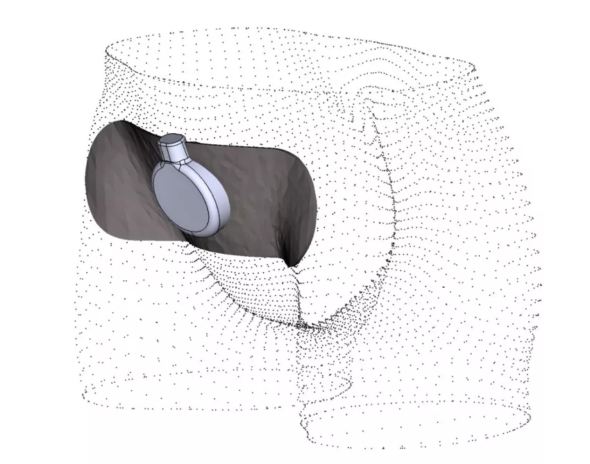 Wizualizacja umiejscowienia głowicy ultradźwiękowej z wkładką pozycjonującą na ciele pacjenta podczas badań